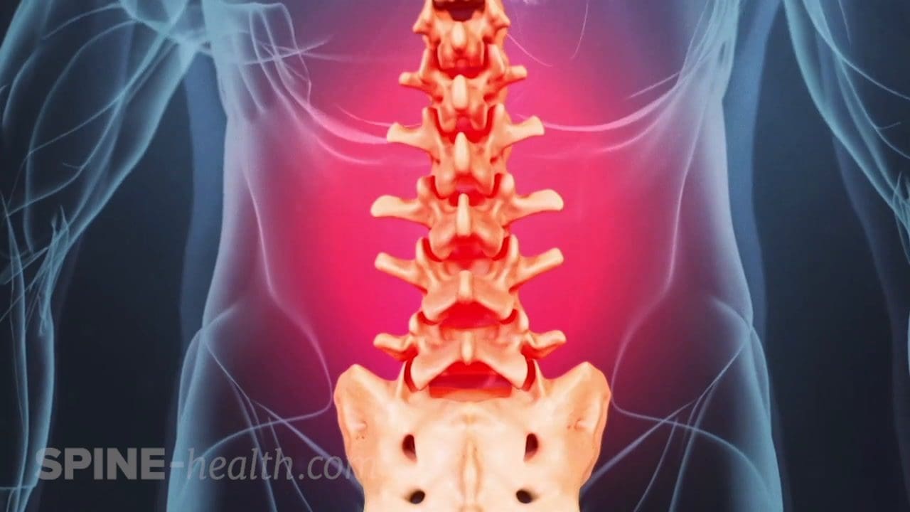 Неспецифическая боль в пояснице