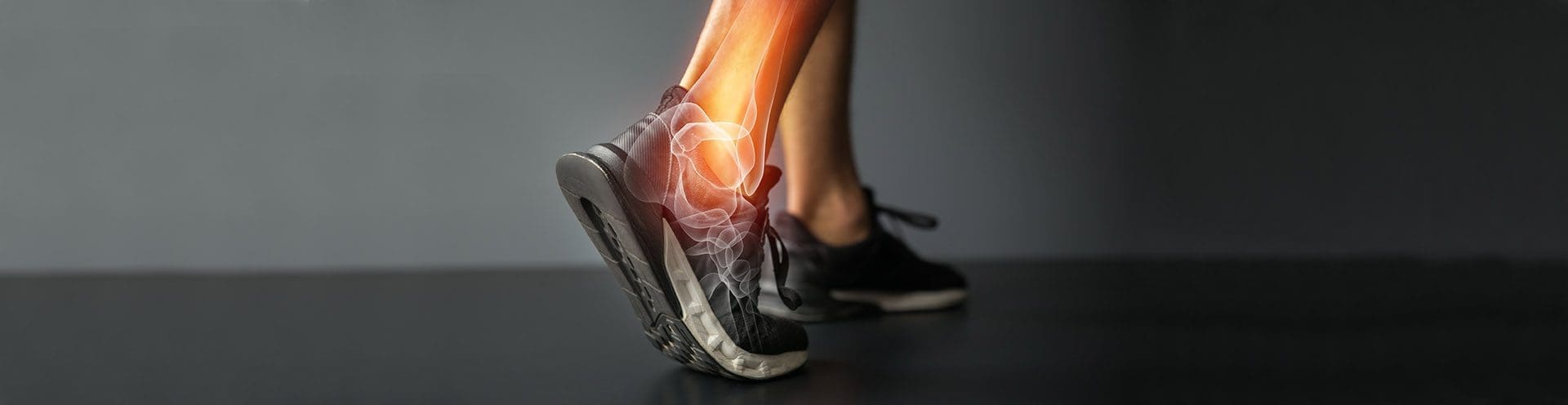 Эндопротезирование голеностопного сустава