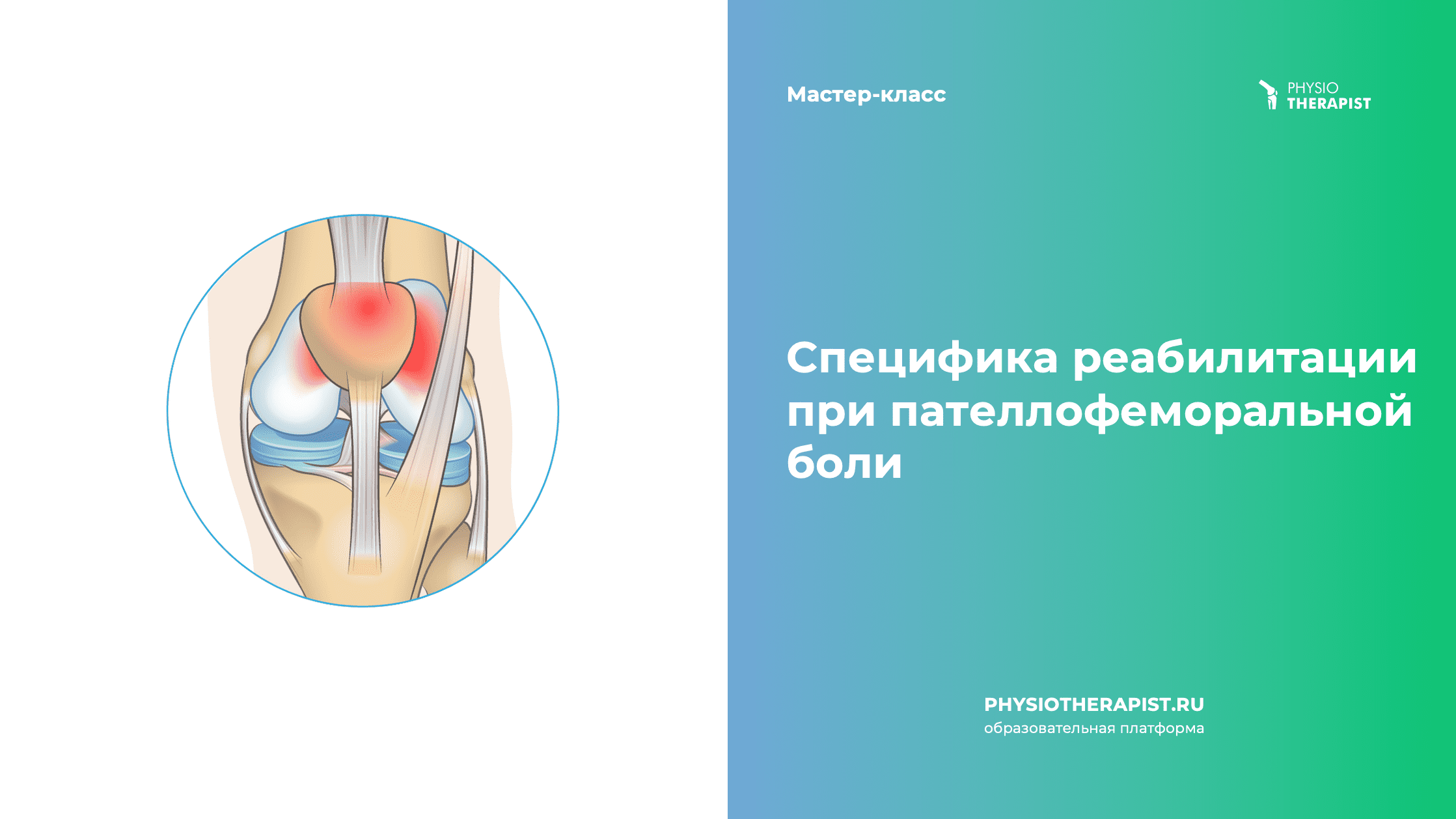 Специфика реабилитации при пателлофеморальной боли
