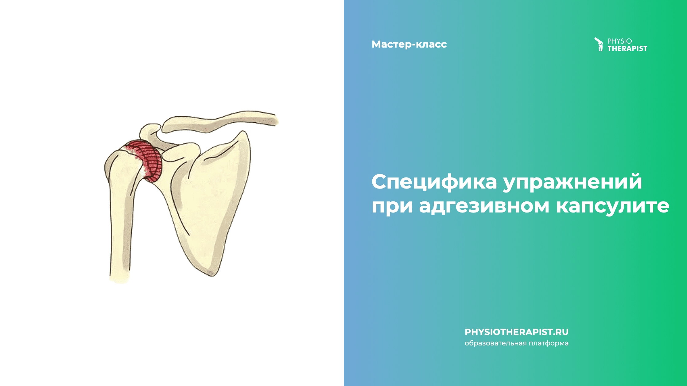 Специфика упражнений при адгезивном капсулите