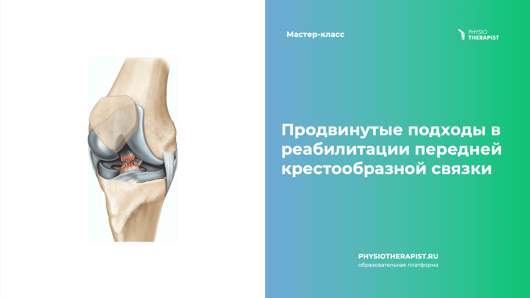 Прикладные подходы в реабилитации передней крестообразной связки